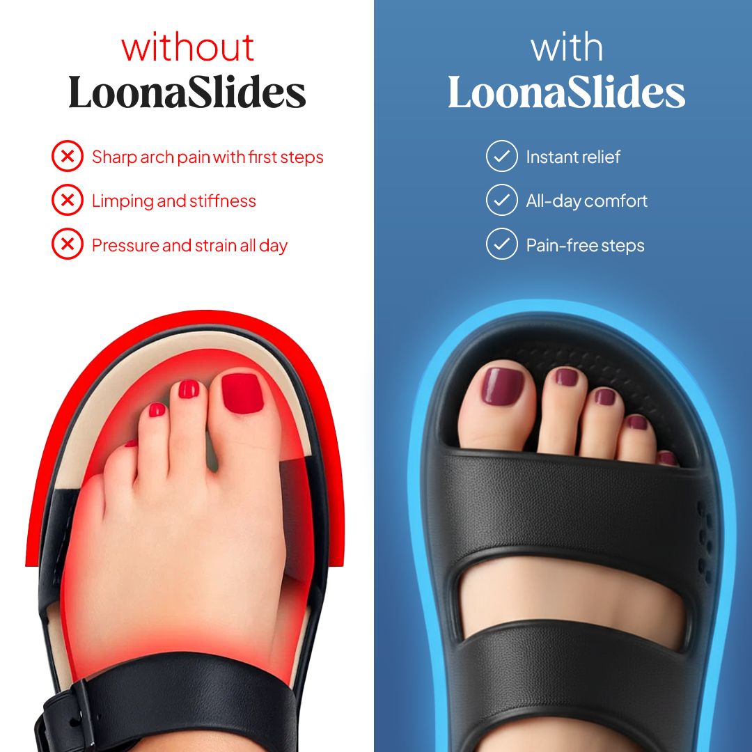 Loona Comfort Arch Support Slides